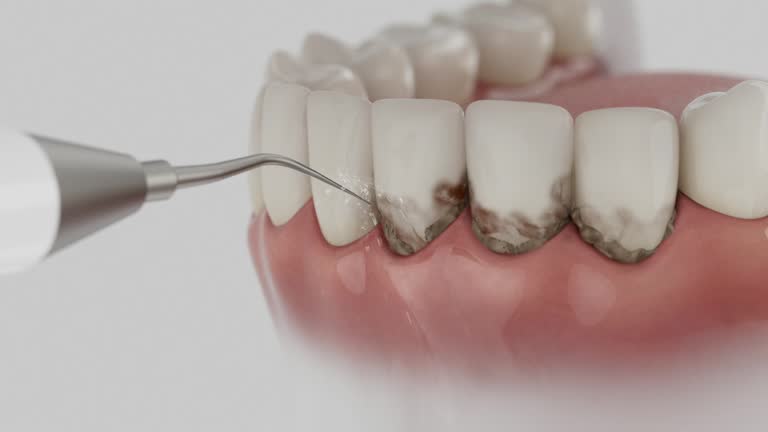 Trusted Teeth Cleaning And Checkup service in El Rio, CA - Dentist Open Now